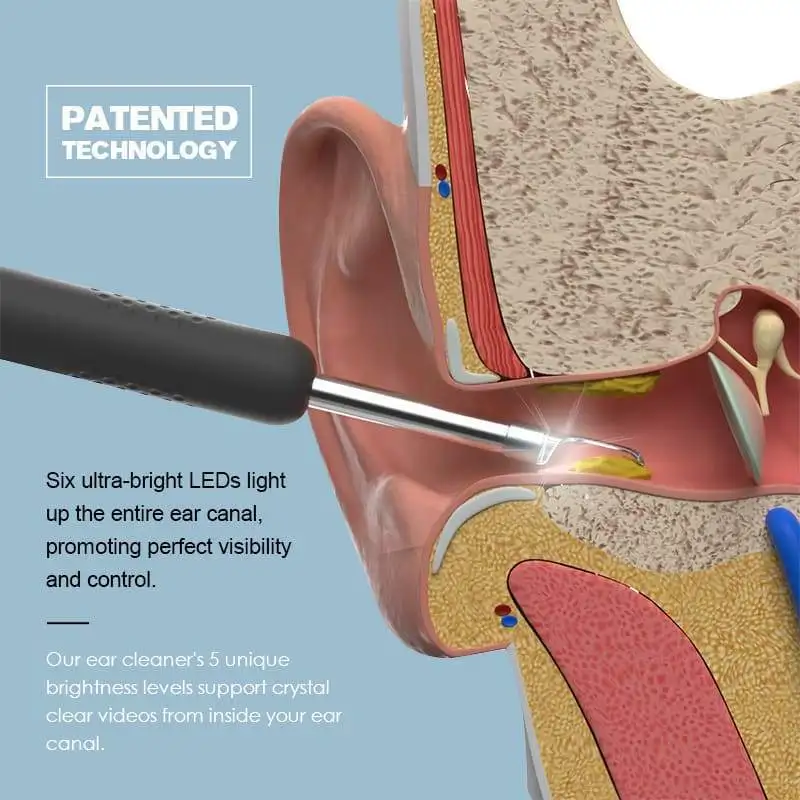 1pc ušného mazu Nástroj pre Odstránenie Bezdrôtový Smart Visual R1 Endoskopu Ucho Vybrať HD ušného mazu ODSTRAŇOVAČ WIFI Pripojenie Príslušenstva